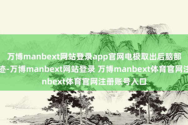 萬博manbext網(wǎng)站登錄app官網(wǎng)電極取出后腦部?jī)H留微細(xì)印跡-萬博manbext網(wǎng)站登錄 萬博manbext體育官網(wǎng)注冊(cè)賬號(hào)入口